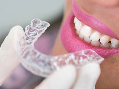 Dental treatments: Orthodontics German Dentist Marbella, San Pedro
