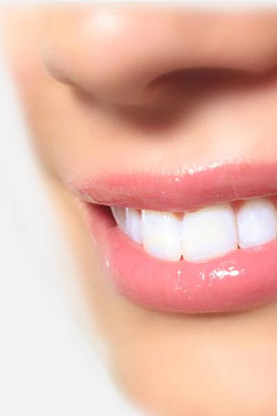 Teeth Whitening - truly effective products are only used in professional bleaching. German Dentist Clinic Marbella San Pedro